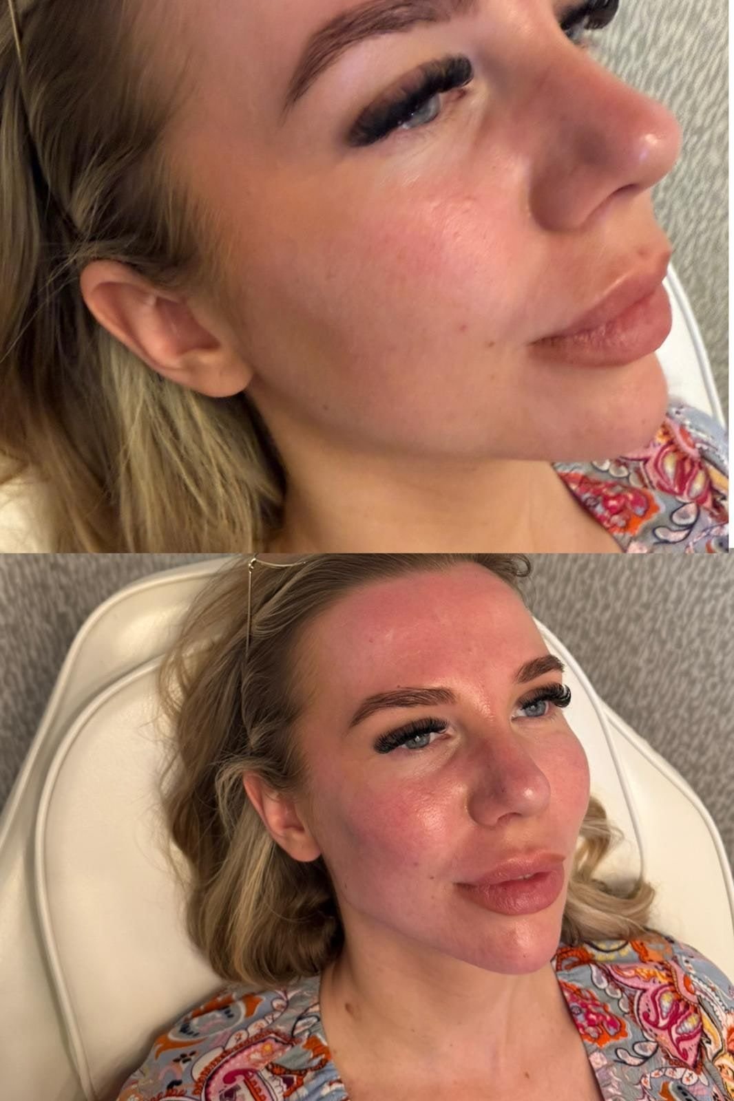 Client result 1