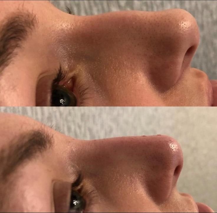 Client result 3
