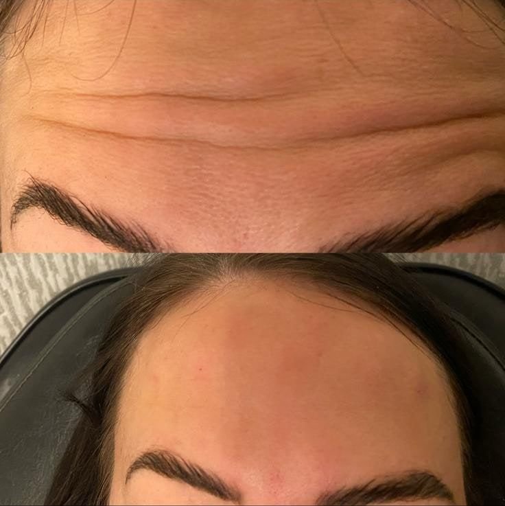 Client result 6